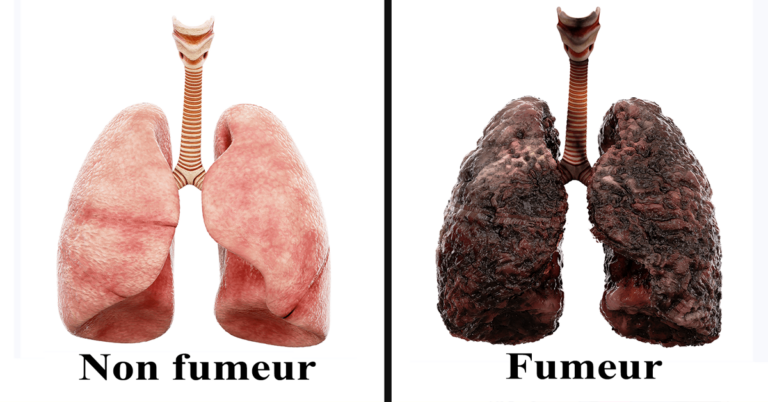 Journée mondiale sans tabac: « Le tabac tue la moitié de ses consommateurs », OMS